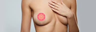 Nipple & Areola Surgery